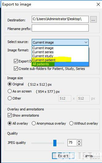 MicroDicom viewer(Dicom格式看圖軟件)