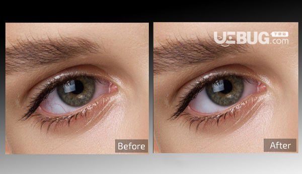 Retouch4me Eye Vessels(圖片處理工具)